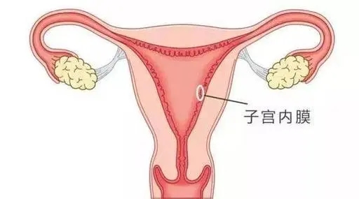 预防子宫性不孕我有妙招