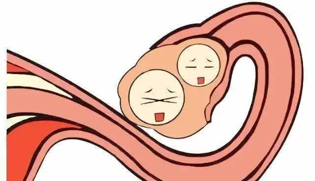 女性不排卵的原因是什么呢？