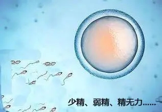 男性死精症是什么原因导致的?